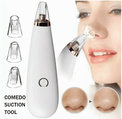 Black Heads Remover